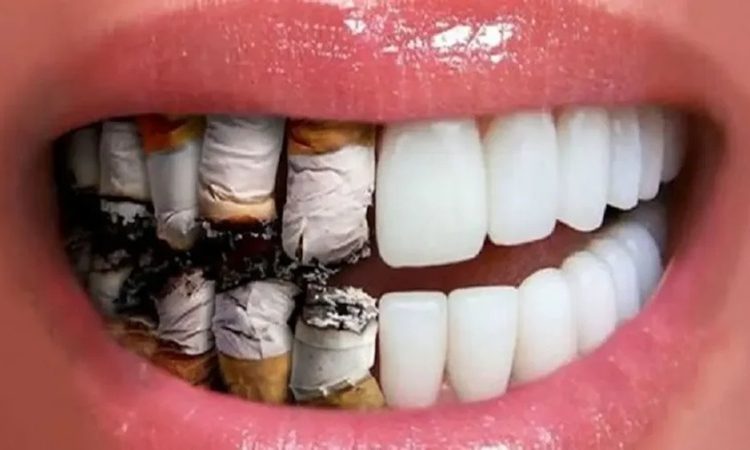 تأثیر سیگار و قلیان بر سلامت لثه و دندان‌ها | دکتر حسین برجیان (بهترین دندانپزشک اصفهان-بهترین جراح لثه اصفهان-بهترین دندانپزشک زیبایی اصفهان)