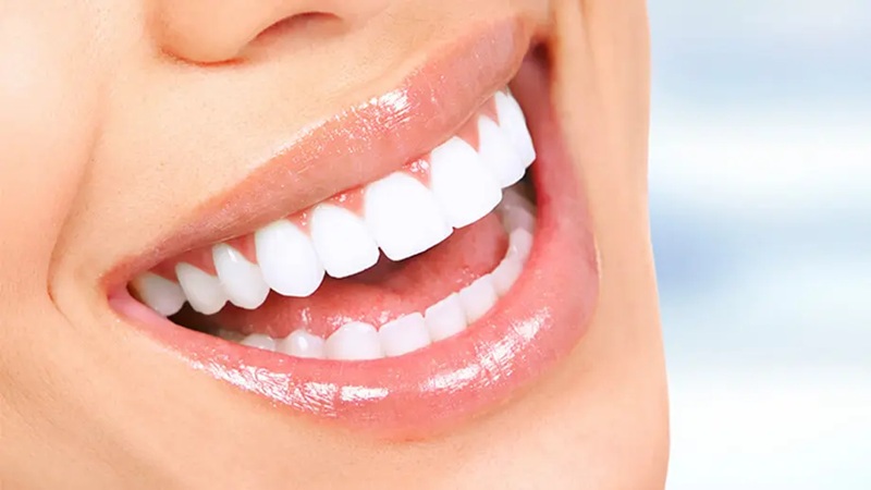 نتیجه نهایی لیفت لثه | بهترین دندانپزشک اصفهان-بهترین جراح لیفت لثه اصفهان-قیمت ایمپلنت دندان اصفهان| دکتر حسین برجیان