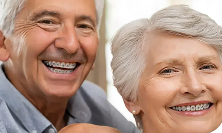 آیا ارتودنسی در بزرگسالی مؤثر است؟ | دکتر حسین برجیان (بهترین دندانپزشک اصفهان-بهترین جراح لثه اصفهان-بهترین دندانپزشک زیبایی اصفهان)