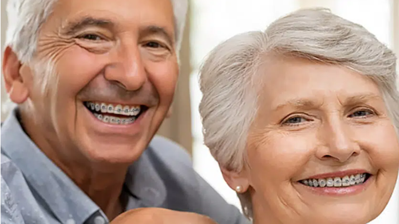 آیا ارتودنسی در بزرگسالی مؤثر است؟ | دکتر حسین برجیان (بهترین دندانپزشک اصفهان-بهترین جراح لثه اصفهان-بهترین دندانپزشک زیبایی اصفهان)