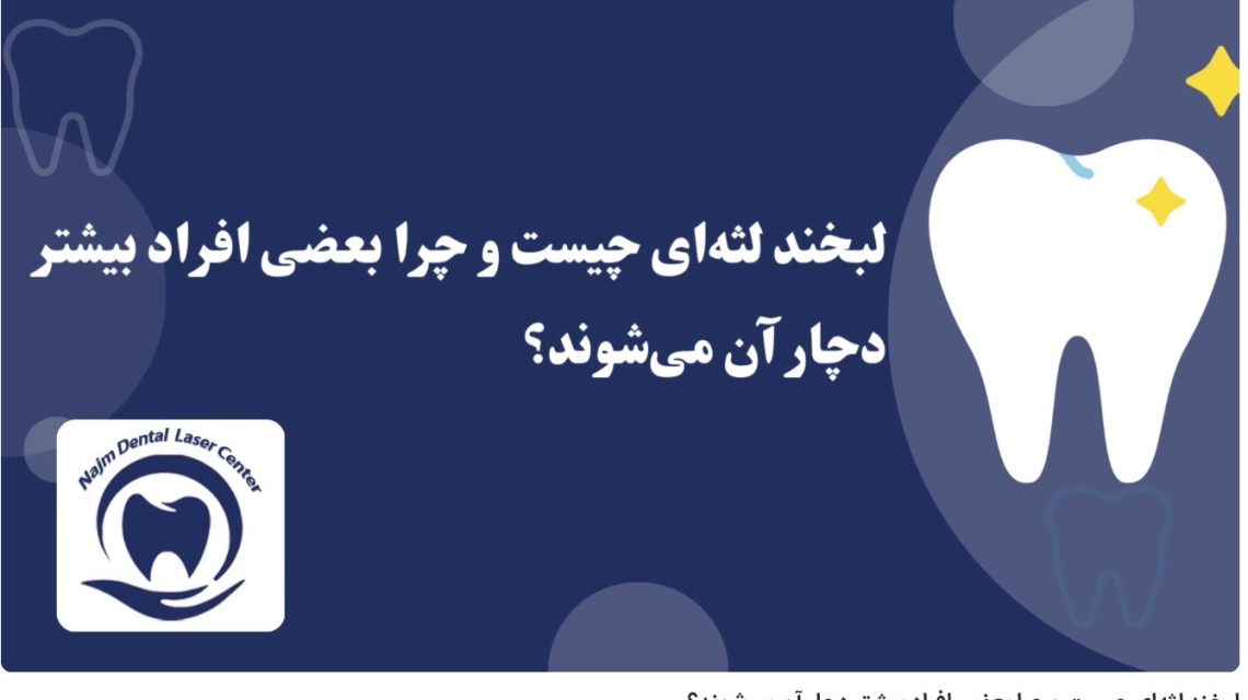 ویدئو آپارات لبخند لثه‌ای چیست و چرا بعضی افراد بیشتر دچار آن می‌شوند؟