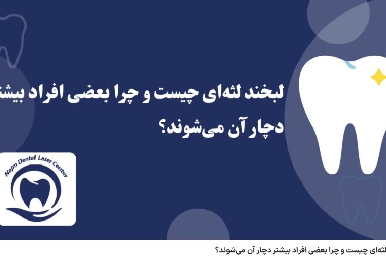 ویدئو آپارات لبخند لثه‌ای چیست و چرا بعضی افراد بیشتر دچار آن می‌شوند؟