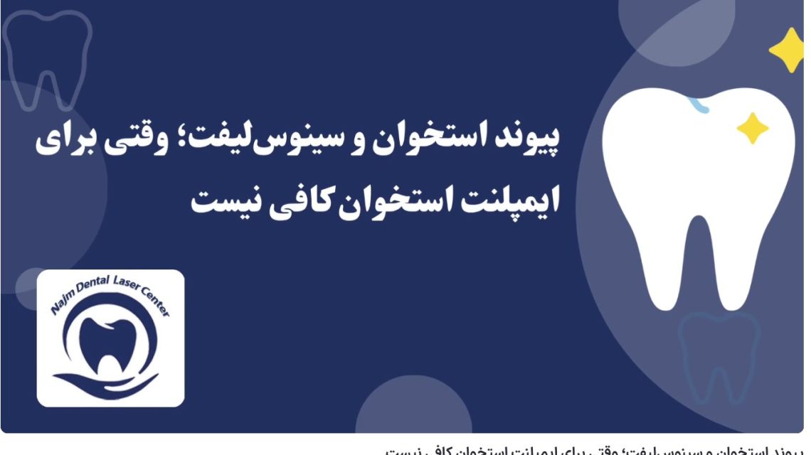 ویدئو آپارات پیوند استخوان و سینوس‌لیفت؛ وقتی برای ایمپلنت استخوان کافی نیست