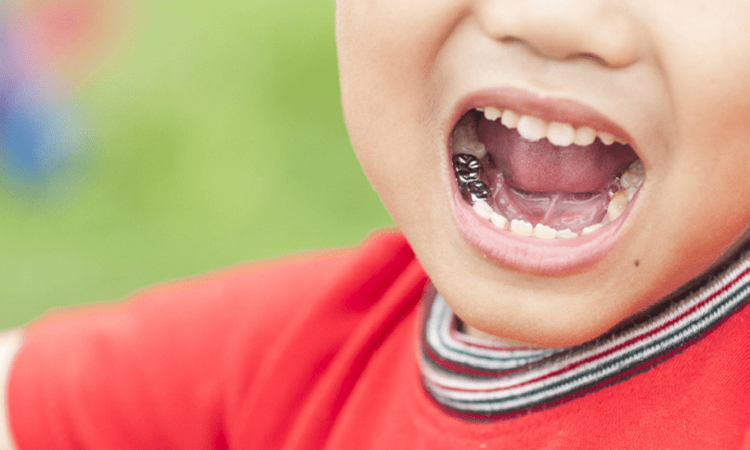 آیا دندان شیری هم نیاز به عصب‌کشی دارد؟ | بهترین دندانپزشک اصفهان-بهترین جراح لیفت لثه اصفهان-قیمت ایمپلنت دندان اصفهان| دکتر حسین برجیان