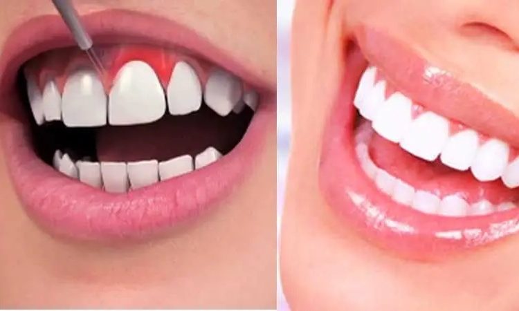 بهترین دندانپزشک اصفهان-بهترین جراح لیفت لثه اصفهان-قیمت ایمپلنت دندان اصفهان| دکتر حسین برجیان