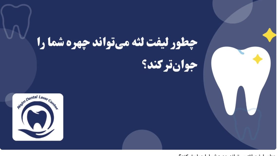 ویدئوآپارات چطور لیفت لثه می‌تواند چهره شما را جوان‌تر کند؟ دکتر حسین برجیان