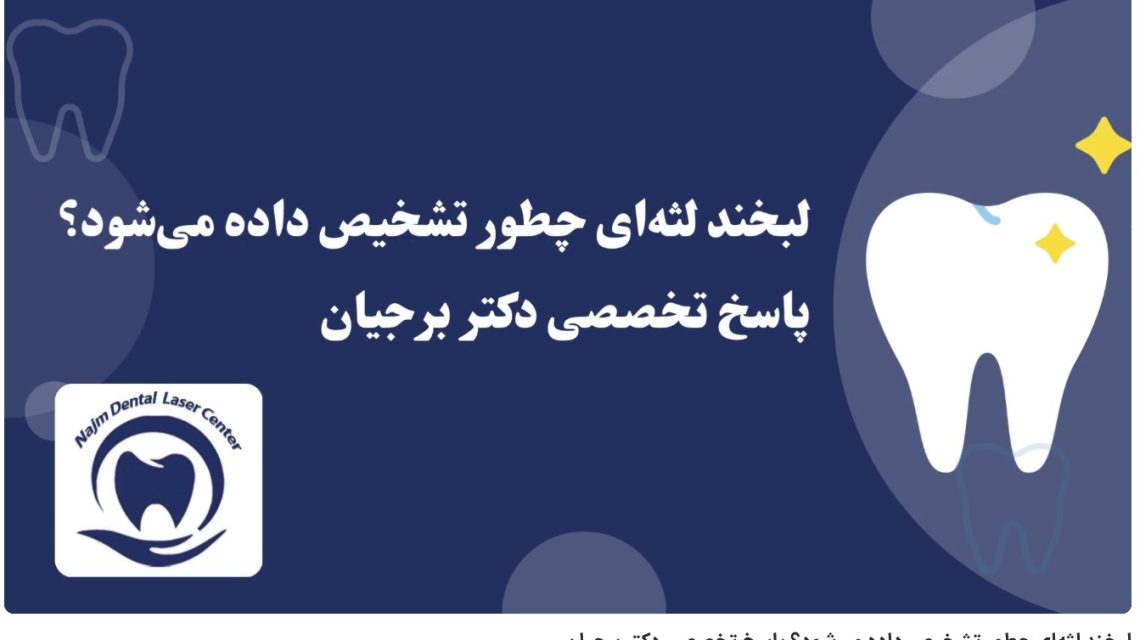 ویدئو آپارات لبخند لثه‌ای چطور تشخیص داده می‌شود؟ پاسخ تخصصی دکتر برجیان