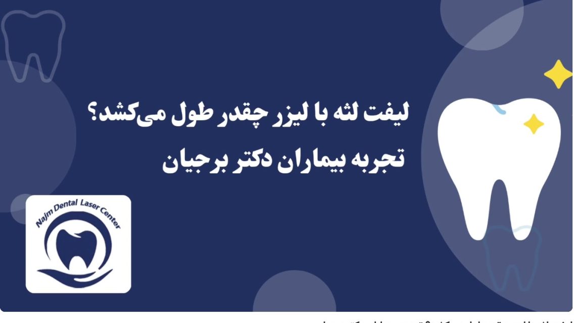 ویدئوآپارات لیفت لثه با لیزر چقدر طول می‌کشد؟ تجربه بیماران دکتر برجیان