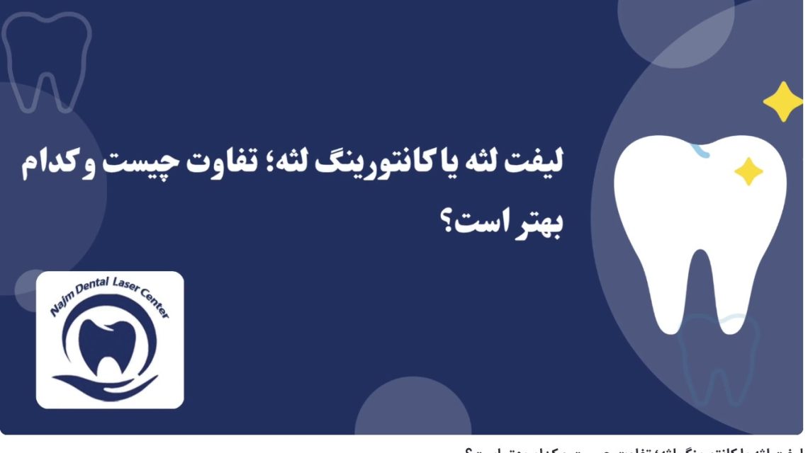 ویدئوآپارات لیفت لثه یا کانتورینگ لثه؛ تفاوت چیست و کدام بهتر است؟ دکتر حسین برجیان