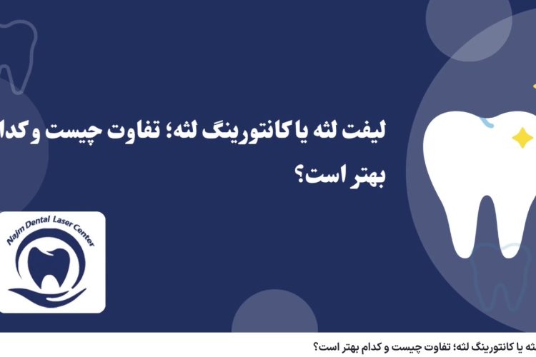 ویدئوآپارات لیفت لثه یا کانتورینگ لثه؛ تفاوت چیست و کدام بهتر است؟ دکتر حسین برجیان