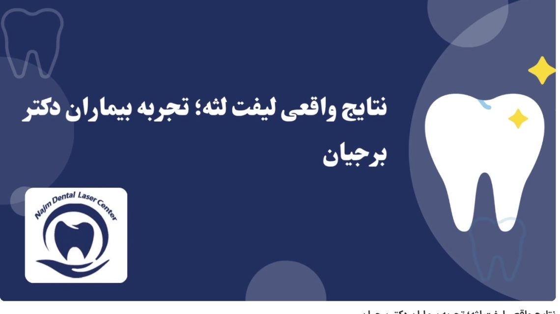 ویدئو آپارات نتایج واقعی لیفت لثه؛ تجربه بیماران دکتر برجیان