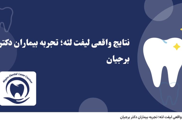 ویدئو آپارات نتایج واقعی لیفت لثه؛ تجربه بیماران دکتر برجیان